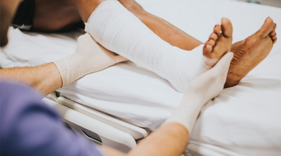 doctor handling a leg in a cast